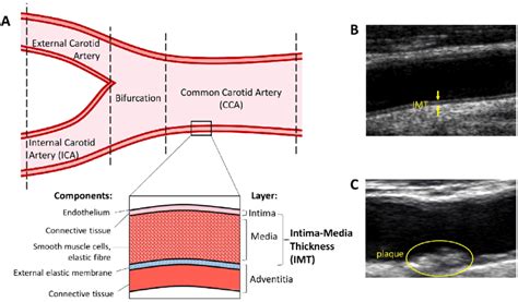 Systemic arteries deliver blood to the rest of the body. Visualization of the carotid artery A) A simplified diagram of the... | Download Scientific Diagram