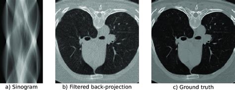 Reconstruction And Measurements For The Low Dose LoDoPaB CT Data