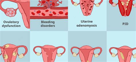 cervix what diseases affect it healthy food near me