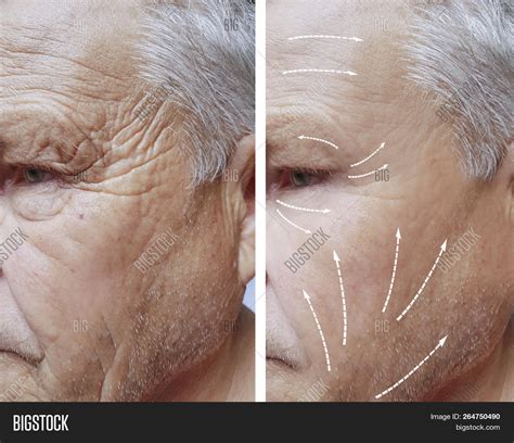 Wrinkled Old Man Face