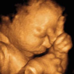 33 Weeks And 2 Days Baby Fetal Progress Ultrasound