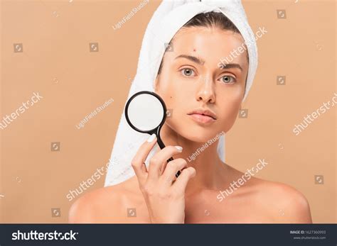 Naked Woman Pimples On Face Holding Stockfoto Shutterstock
