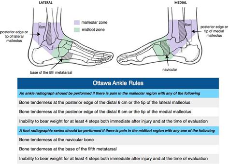 Rosh Review With Images Medical Training Sprained Ankle Nursing