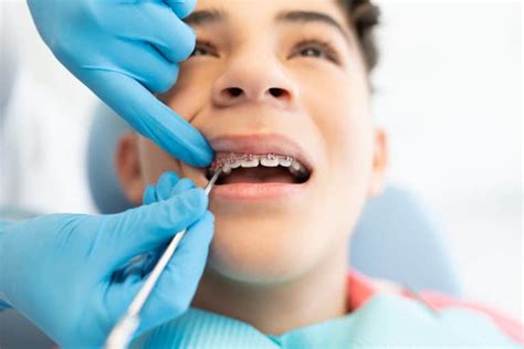 When To Start Orthodontic Treatment Dhingra Orthodontics