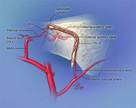 Illustration Of Facial Nerve Arterial Supply The Tympanic And Mastoid