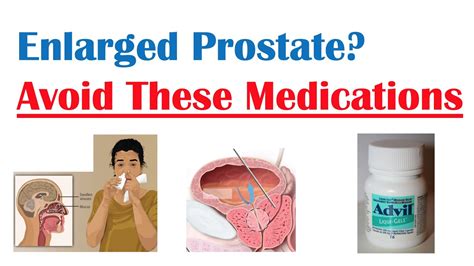 Medications To Avoid With Enlarged Prostate Reduce Symptoms And Risk Of Prostate Enlargement
