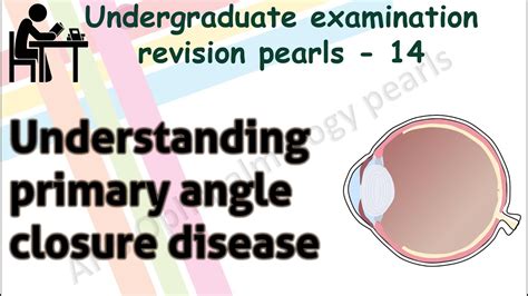 Understanding Primary Angle Closure Disease Undergraduate Examination
