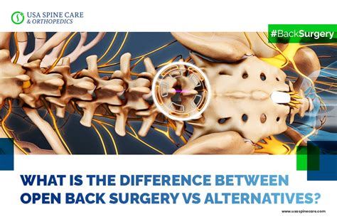 What Is The Difference Between Open Back Surgery Versus The