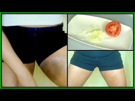 Mar 23, 2018 · orange peel has mild exfoliating and bleaching properties that help in lightening the dark skin on inner thighs. HOW TO LIGHTEN DARK INNER THIGHS FAST |CLEAR DARK INNER ...