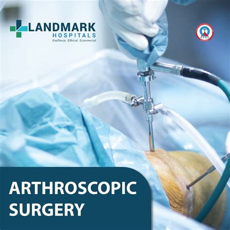 Arthroscopic Surgery Indications Benefits And Recovery Landmark