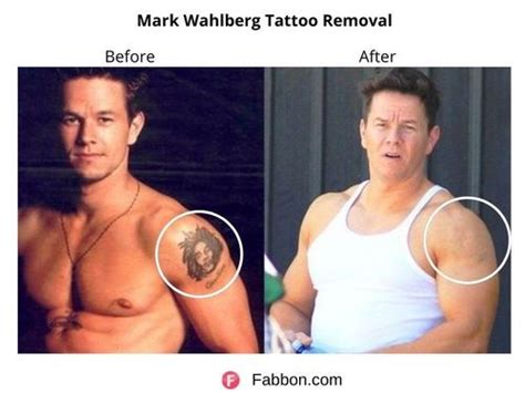 25 Celebritities Who Removed Their Tattoos Fabbon