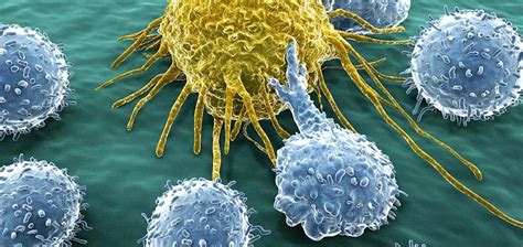 精彩大片！人体免疫细胞原来是这样追杀肿瘤细胞的！细胞肿瘤大片淋巴nk细胞免疫系统军队病原体 健康界