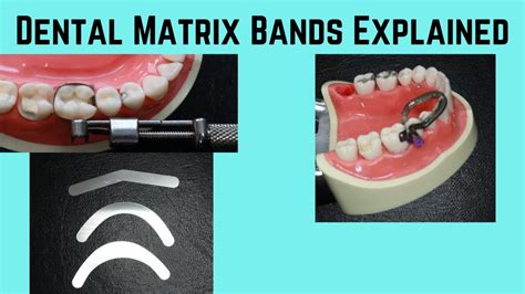 What Is A Dental Matrix Band Youtube