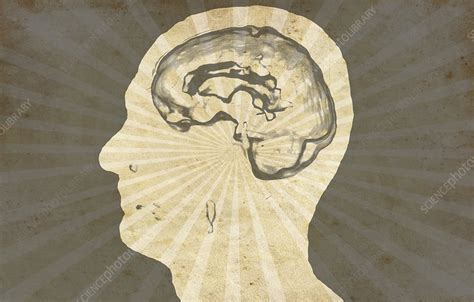 Healthy Brain Ct Scan Stock Image C0533155 Science Photo Library