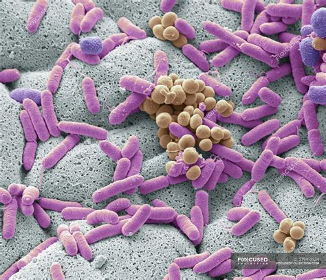 Microbiology Chapters 9 10 11 12 And General Jeopardy Template