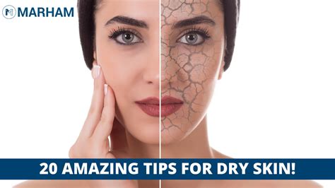 How To Moisturize Dry Skin In Winter 20 Tips Marham
