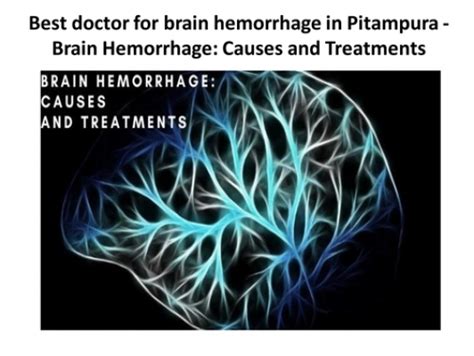 Best Doctor For Brain Hemorrhage In Pitampura Brain Hemorrhage Causes