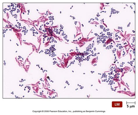 Bacteria Stains Gram Endospore Capsular Acid Fast Biology