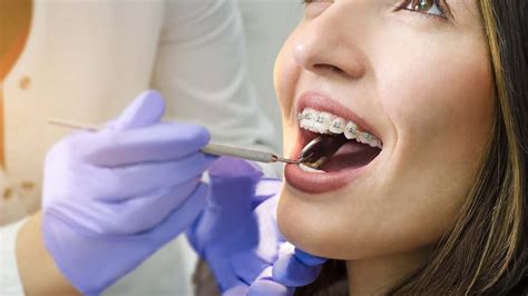 How Much Are Braces With Insurance West Hollywood Holistic And