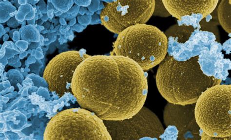 Maybe you would like to learn more about one of these? Home Remedies to Treat MRSA Infection