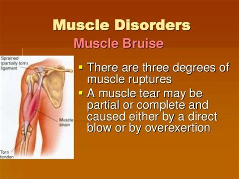 The Muscle System Disorder
