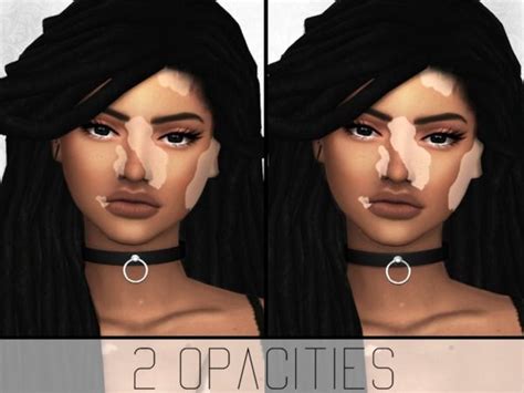 Simplypixelated Vitiligo Overlay The Sims 4 Skin Sims 4 Sims 4 Cc