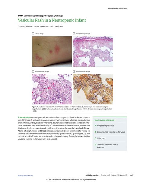 Vesicular Rash In A Neutropenic Infant Allergy And Clinical