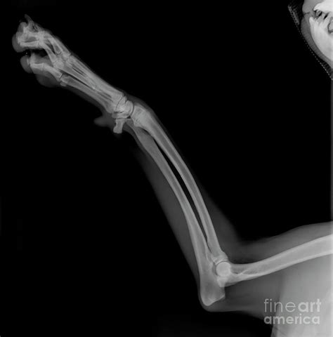 X Ray Of A Dogs Front Left Leg Photograph By Yael Rosen Pixels