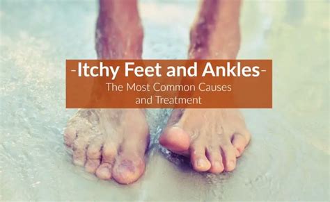 Itchy Feet And Ankles Causes Symptoms Treatment