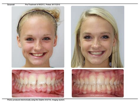 Orthodontist Near Me Orthodontist Orthodontics Invisalign