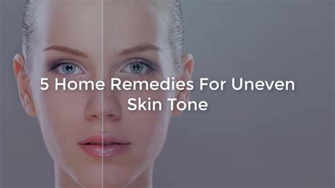 Home Remedies For Uneven Skin Tone Top 5 Beauty Tips Youtube