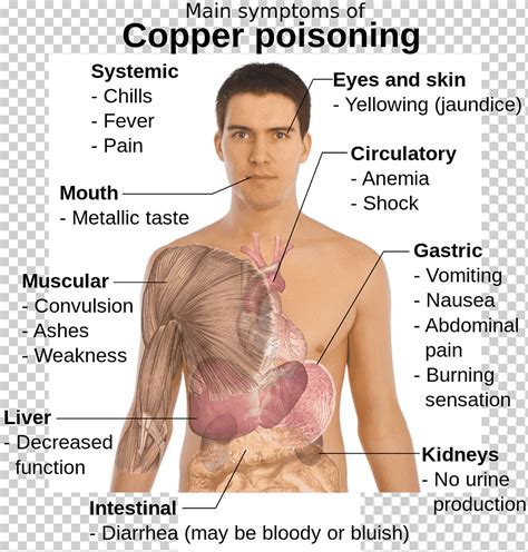 Síntomas de la enfermedad del veneno toxicidad del cobre anemia