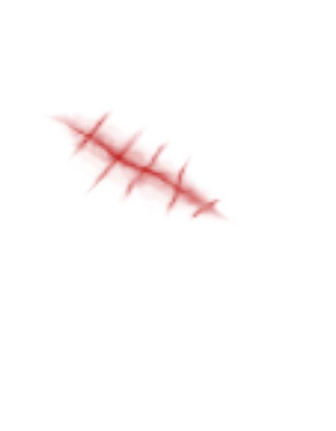Realistic Scar Png - PNG Image Collection png image
