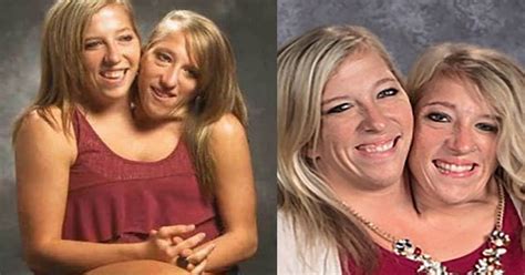 Meet abigail and brittany hensel, dicephalic conjoined twins. Abigail & Brittany Hensel - The Twins Who Share a Body ...