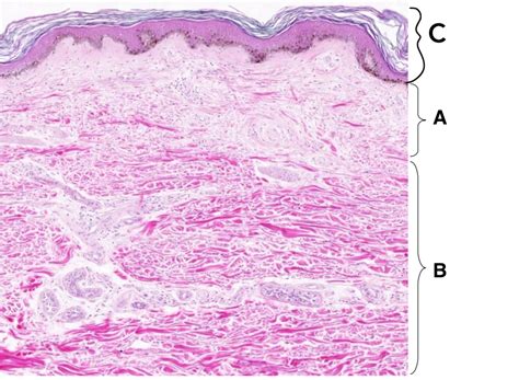 Skin Histology Squamous Sweat Gland Stratified Squamous Epithelium