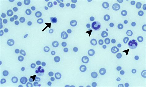 Nucleated Red Blood Cells Cells And Smears