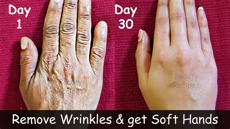 Remove Wrinkles From Hands Make Your Hands Look 10 Years Younger