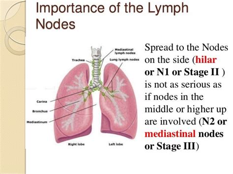 Lung Cancer Video1