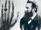 How Wilhelm Roentgen Discovered X-ray? – Different Truths | Wilhelm ...