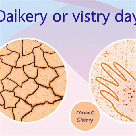 Why Is My Skin So Dry And Flaky Causes Solutions And Strategies For Managing The Knowledge Hub