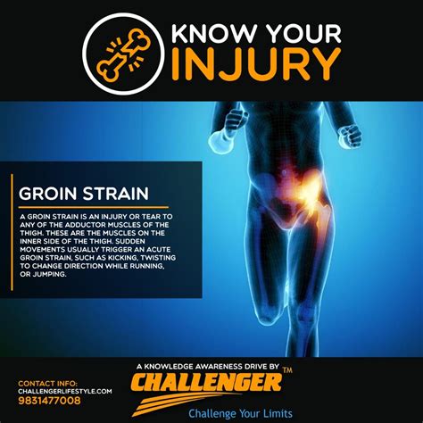 Pin On Know Your Injury