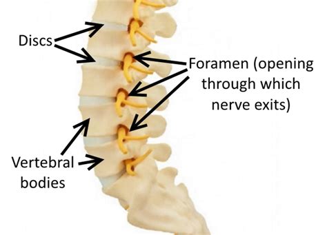 Foraminal Stenosis Drwolgin