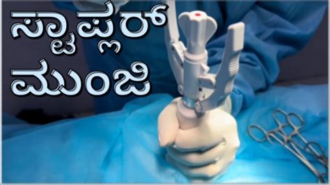 Stapler Circumcision In 5 Minutes Dr C Sharath Kumar Sexologist