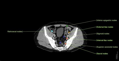 Lymph Nodes Normal Anatomy E Anatomy