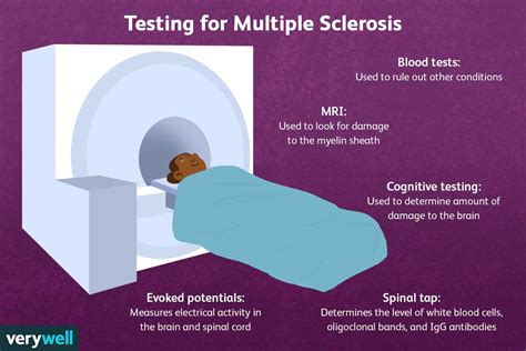 Multiple Sclerosis Diagnostic Criteria Stages Tests