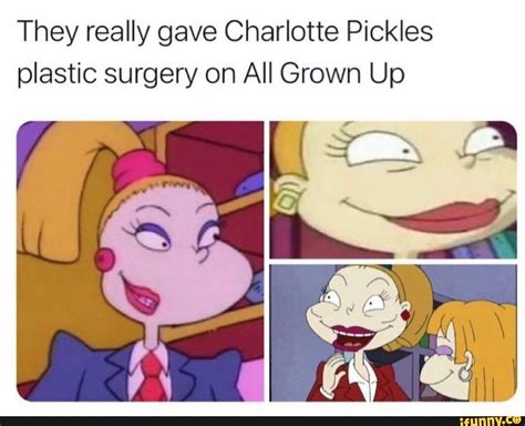 They Really Gave Charlotte Pickles Plastic Surgery On All Grown Up Ifunny
