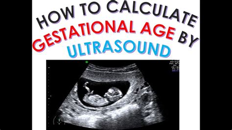 how to calculate gestational age and edd due date by ultrasound dating scan second trimester