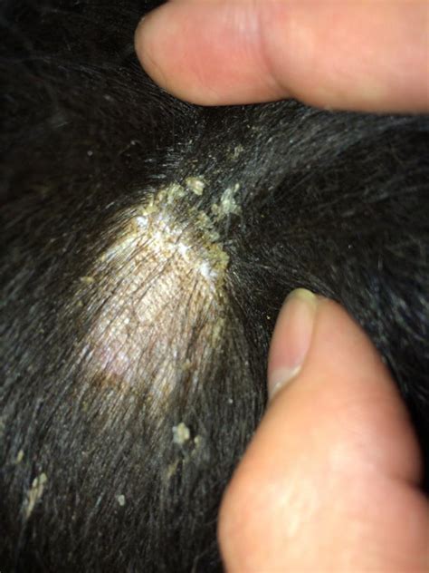 Dog Losing Hair And Flaky Skin Mitesmange Puppy Forum And Dog Forums