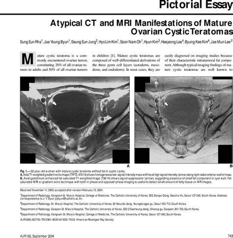 Atypical Ct And Mri Manifestations Of Mature Ovarian Cystic Teratomas Ajr