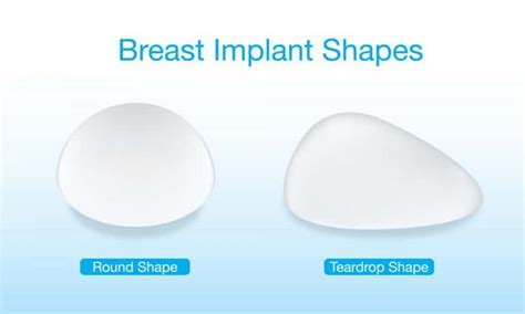 Teardrop Breast Implants Ultimate Guide Centre For Surgery